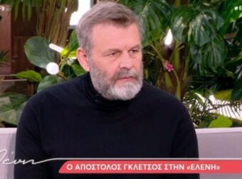 Απόστολος Γκλέτσος: Όλη η αλήθεια για την αλλαγή στην εμφάνισή του