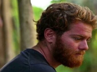 Δεν είναι μόνο ο Τζέιμς στο Survivor – «Κόπηκε» διάσημος τραγουδιστής με πρόβλημα υγείας