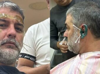Άουτς, αυτό πόνεσε: Ο Μπισμπίκης κάνει αποτρίχωση σε πρόσωπο, αυτιά και ρουθούνια και το ανεβάζει live στο Instagram