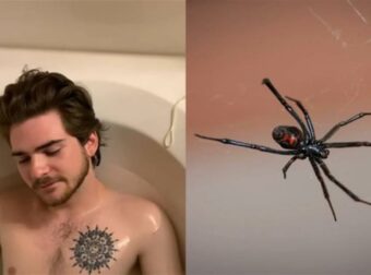 Τι φιντάνι είναι αυτό: Youtuber άφησε Μαύρη Χήρα να τον δαγκώσει – «Είναι ο πιο οδυνηρός πόνος που έχω νιώσει» (video)