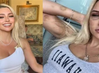 Αποκάλυψη σοκ: Μοντέλο έγινε σκλάβα του σeξ και βασανίστηκε από τον πρώην της (photo)