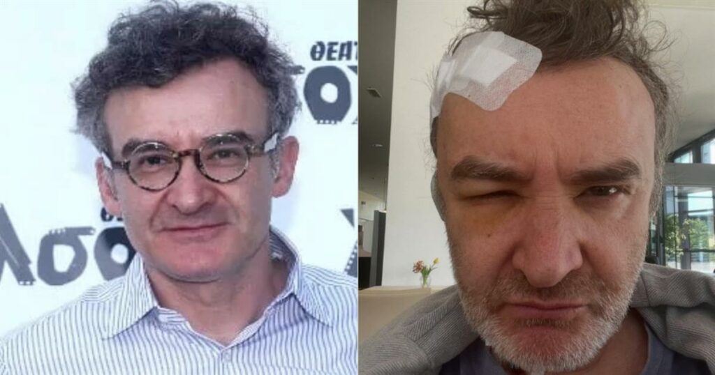 Νίκος Ορφανός: Η συγκλονιστική μάχη του με τον όγκο στο κεφάλι – Όσα αποκαλύπτει για τη χειρουργική επέμβαση στη Γερμανία για το κρανιοφαρυγγίωμα.