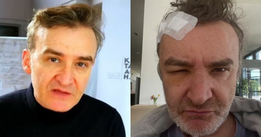 Νίκος Ορφανός: Άγνωστη δοκιμασία με εγχείρηση εγκεφαλικού όγκου – Η απρόσμενη ιστορία του γνωστού ηθοποιού.