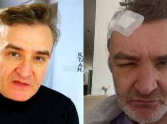 Νίκος Ορφανός: Άγνωστη δοκιμασία με εγχείρηση εγκεφαλικού όγκου – Η απρόσμενη ιστορία του γνωστού ηθοποιού.