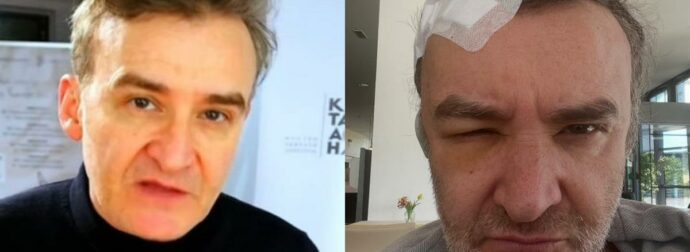 Νίκος Ορφανός: Άγνωστη δοκιμασία με εγχείρηση εγκεφαλικού όγκου – Η απρόσμενη ιστορία του γνωστού ηθοποιού.