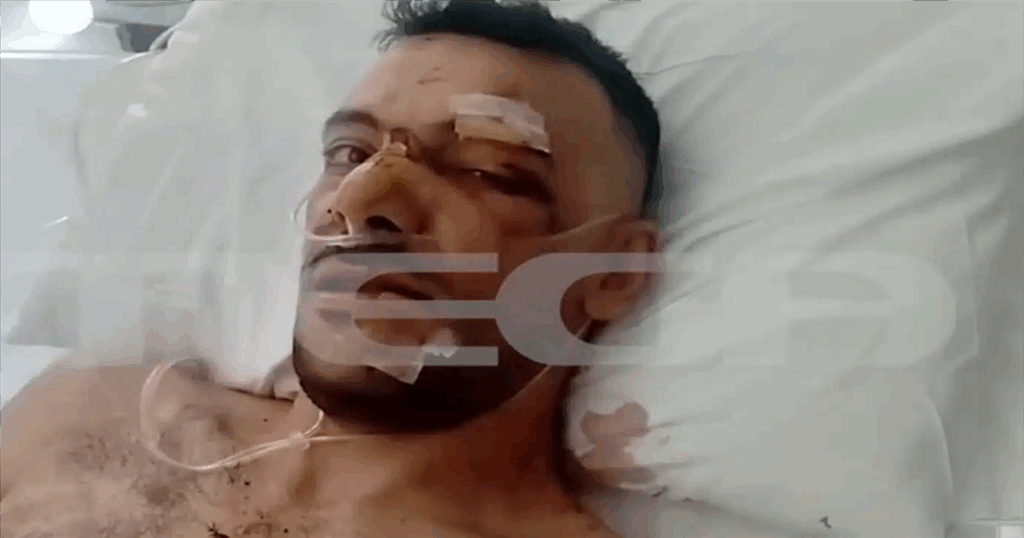 Θαύμα επιβίωσης: 35χρονος διαφεύγει τον θάνατο μετά από 18 μαχαιριές σε πανηγύρι, με σοβαρές ζημιές σε πνεύμονα και διάφραγμα.