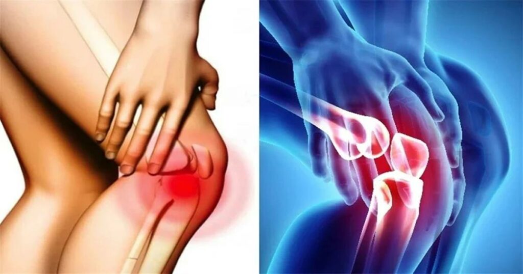 Πονάτε στα γόνατα; Ανακαλύψτε τα ιδανικά παπούτσια για ανακούφιση και ποια να αποφεύγετε σύμφωνα με τους ειδικούς!