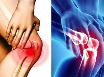 Πονάτε στα γόνατα; Ανακαλύψτε τα ιδανικά παπούτσια για ανακούφιση και ποια να αποφεύγετε σύμφωνα με τους ειδικούς!