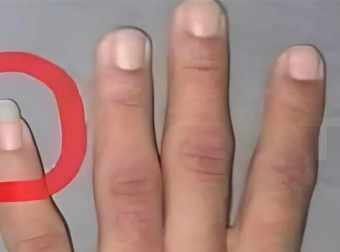 Γιατί κάποιοι άντρες επιλέγουν να αφήνουν μακρύ το νύχι του μικρού δαχτύλου; Ανακαλύψτε τους λόγους πίσω από αυτή την ασυνήθιστη συνήθεια!