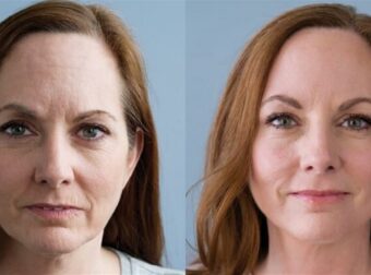 10 Καθημερινές Συνήθειες που σε Προσθέτουν Χρόνια στην Εμφάνισή σου!