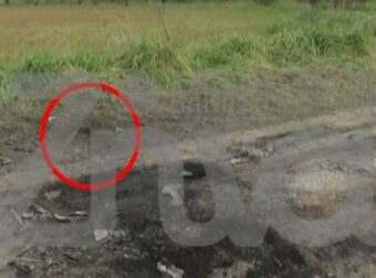 Μυστηριώδης Υπόθεση στην Πιερία: Τι Κρύβεται πίσω από τον Απανθρακωμένο 48χρονο με τα Ελλείποντα Δόντια και Οστά;