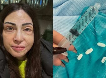 Παλιοσπύρου: Εικόνες και βίντεο από την επίπονη πορεία της ανάρρωσης – «Πώς αντέχω, με ρωτάς…»
