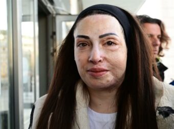 Ιωάννα Παλιοσπύρου: Η συναισθηματική εξομολόγηση για τις ουλές από την επίθεση με βιτριόλι – «Πώς βρίσκω τη δύναμη…»