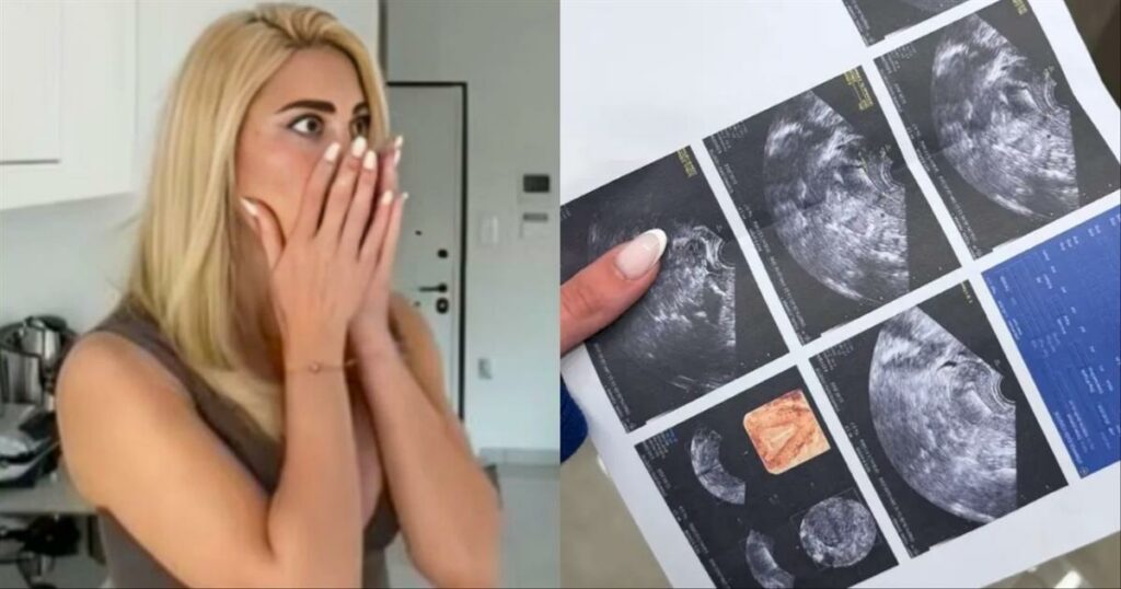 «Έκπληξη εγκυμοσύνης: Η Ιωάννα Τούνη μοιράστηκε υπέρηχο σε βίντεο και αποκαλύφθηκε αυτό που προσπαθούσε να κρατήσει μυστικό!»