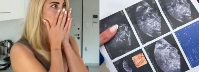 «Έκπληξη εγκυμοσύνης: Η Ιωάννα Τούνη μοιράστηκε υπέρηχο σε βίντεο και αποκαλύφθηκε αυτό που προσπαθούσε να κρατήσει μυστικό!»