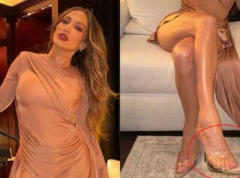 Αναταραχή στα social media: Η Τζένιφερ Λόπεζ με φαινομενικά έξι δάχτυλα στα πόδια σε φωτογραφία!