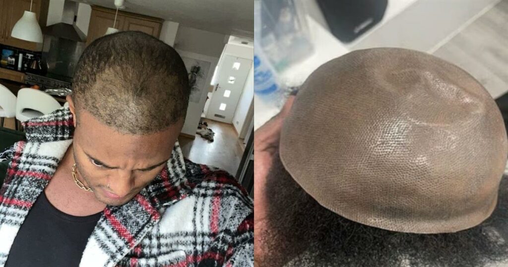 Ο «Mr Tinder» Αποκαλύπτει: Το Μυστικό με τις Περούκες που Έκρυβα για 14 Χρόνια