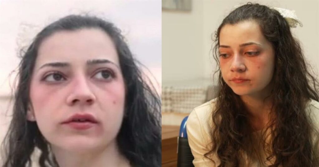 Συγκλονίζει ο θάνατος της 25χρονης Νοέλια Καστίγιο: Μια ιστορία που συγκίνησε όλο τον κόσμο.