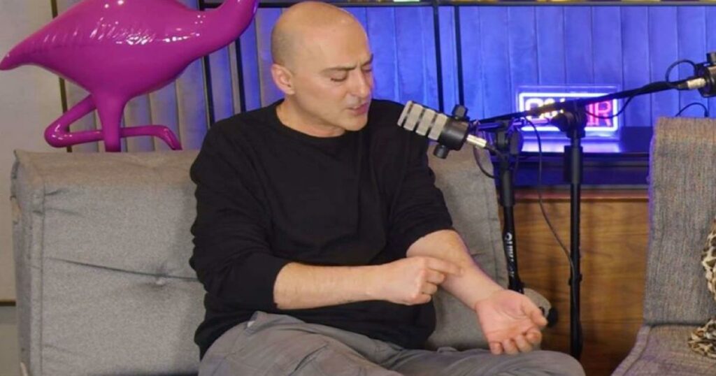 Θανάσης Αλευράς για τη ψωρίαση: «Ένας συνεχιζόμενος διάλογος με το σώμα μου: “Γιατί εγώ;”»