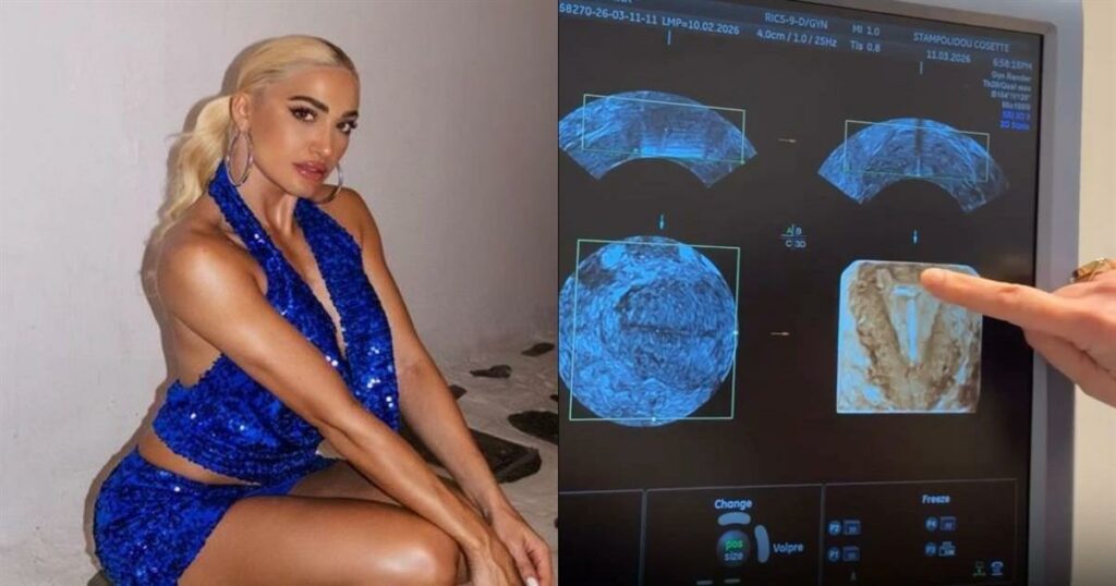 Ιωάννα Τούνη: Μοιράστηκε τη στιγμή της τοποθέτησης σπιράλ με τους διαδικτυακούς της φίλους!