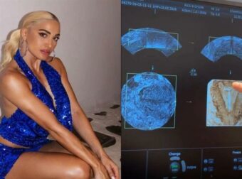 Ιωάννα Τούνη: Μοιράστηκε τη στιγμή της τοποθέτησης σπιράλ με τους διαδικτυακούς της φίλους!