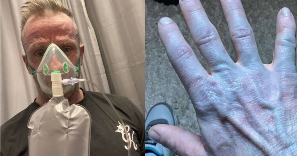 Αναπάντεχα μπλε ξύπνημα: Οι γιατροί έκλαψαν από τα γέλια μόλις τον είδαν!