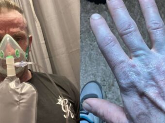 Αναπάντεχα μπλε ξύπνημα: Οι γιατροί έκλαψαν από τα γέλια μόλις τον είδαν!