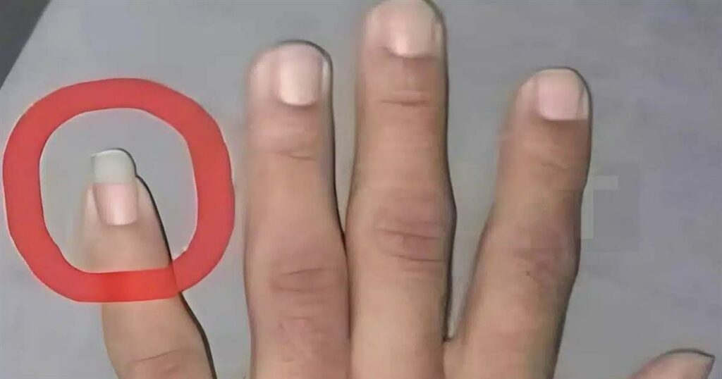 Γιατί ορισμένοι άνδρες επιλέγουν να κρατούν το νύχι του μικρού τους δαχτύλου μακρύ; Ανακαλύψτε τους λόγους!