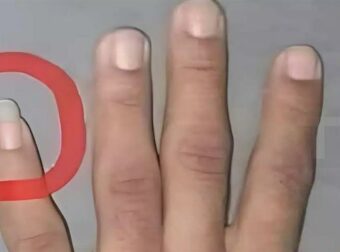 Γιατί ορισμένοι άνδρες επιλέγουν να κρατούν το νύχι του μικρού τους δαχτύλου μακρύ; Ανακαλύψτε τους λόγους!
