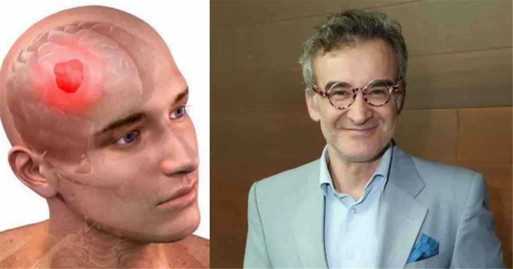 Επεμβαίνει σε όγκο εγκεφάλου ο Νίκος Ορφανός: Ανακαλύψτε τα ύπουλα συμπτώματα και τις σύγχρονες θεραπείες.