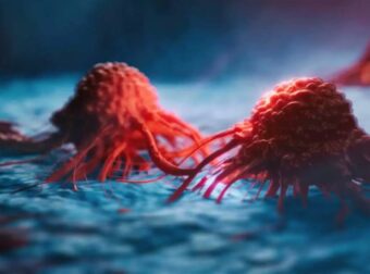 Δυναμώνοντας το σώμα: Η καινοτόμος θεραπεία που φέρνει επανάσταση στη μάχη κατά του καρκίνου.