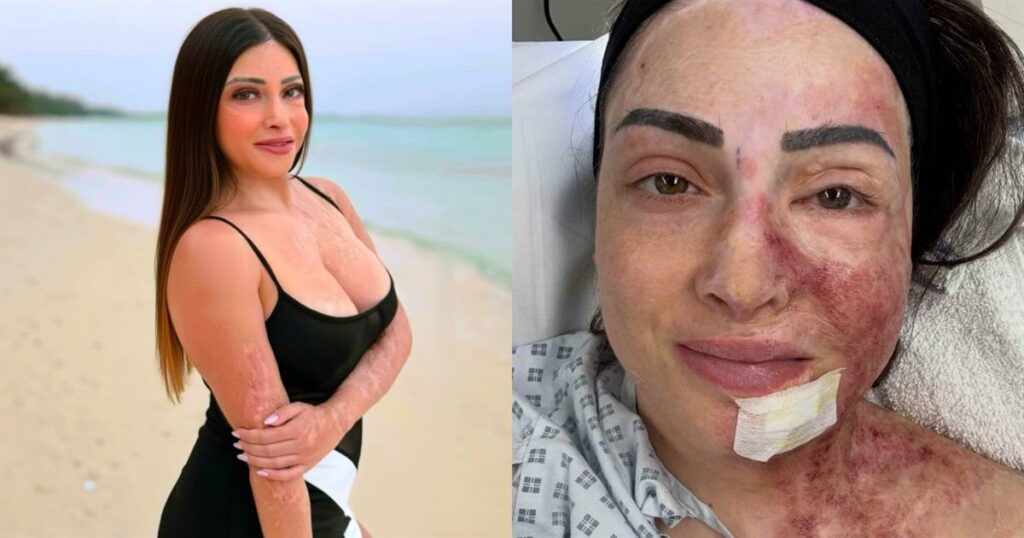 Ιωάννα Παλιοσπύρου: Συγκινεί με την ενημέρωση για τις πρωτοποριακές θεραπείες της στην Αγγλία!