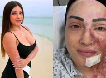 Ιωάννα Παλιοσπύρου: Συγκινεί με την ενημέρωση για τις πρωτοποριακές θεραπείες της στην Αγγλία!