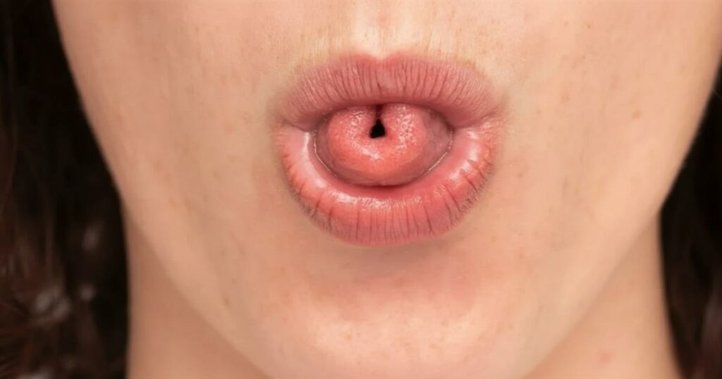 “Τι αποκαλύπτει για την ψυχολογία σου η ικανότητα να διπλώνεις τη γλώσσα σε σχήμα «U»;”