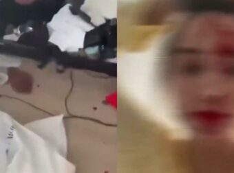 Γνωστό μοντέλο αποκαλύπτει: Βίαιη επίθεση από στυλίστα σε ξενοδοχείο στις Κάννες – Συγκλονιστικά βίντεο έρχονται στη δημοσιότητα.
