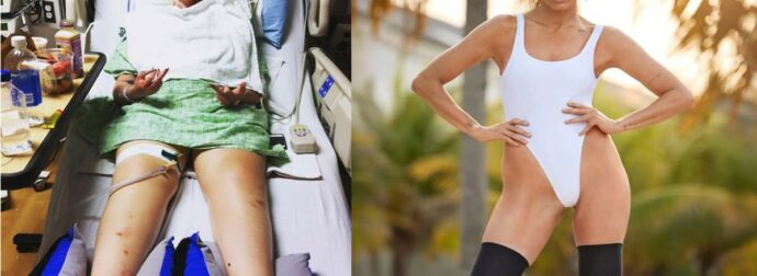 Η ιστορία της Λόρεν Γουάσερ: Πώς η χρήση ταμπόν της άλλαξε τη ζωή – Η συγκλονιστική εμπειρία που αφορά το 90% των γυναικών.