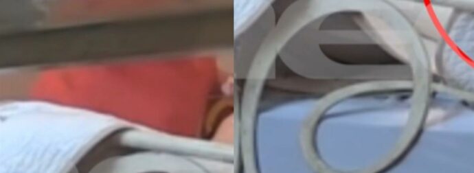 Χίος – «Σταμάτα, δεν φταίω»: Η φρίκη που βίωσε 84χρονη με άνοια από τη «φροντίστριά» της – Συγκλονιστικό βίντεο ντοκουμέντο.