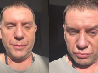 Γιώργος Μαζωνάκης: «Θα του κόψω το κεφάλι» – Απαντά μετά τα σχόλια για το μαυρισμένο μάτι και τα σημάδια στο πρόσωπο