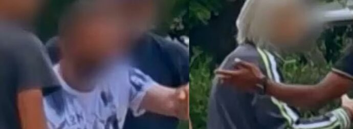 Ξυλοδαρμός στην Καλλιθέα: Ο 21χρονος μιλάει για την άγρια επίθεση του οδοντιάτρου – «Του φώναζα να σταματήσει.. δεν άκουγε τίποτα»