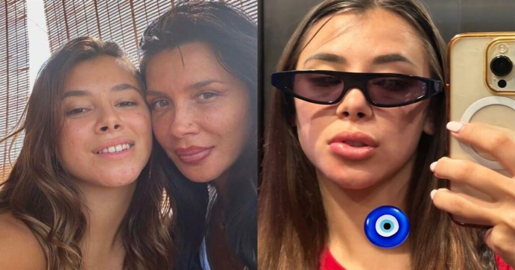 «Σαν αποτυχημένο υαλουρονικό!»: Η κόρη της Πάολα παραμορφώθηκε – Τι συνέβη (Βίντεο)