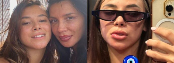 «Σαν αποτυχημένο υαλουρονικό!»: Η κόρη της Πάολα παραμορφώθηκε – Τι συνέβη (Βίντεο)