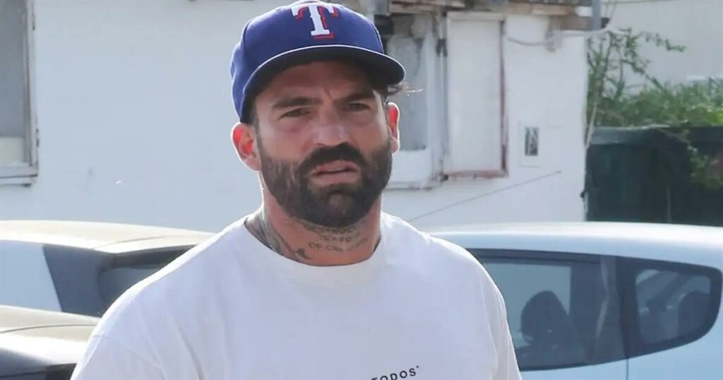 Δημήτρης Αλεξάνδρου: Τραυματίστηκε από επίθεση σκύλου: «Είμαι ένας άνθρωπος 100 κιλά, κράτησα την ψυχραιμία μου»