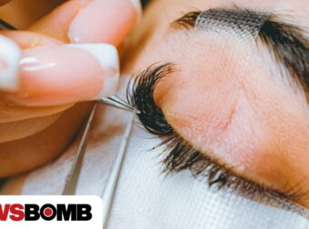 Γυναίκα υπέστη ανεπανόρθωτες βλάβες από βλεφαροπλαστική από ειδικευόμενο γιατρό