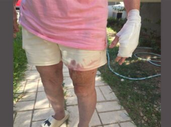 Σκυλιά που φέρονται να ανήκουν σε συγγενικό πρόσωπο του Στέφανου Τσιτσιπά δάγκωσαν 3 άτομα στη Βάρη