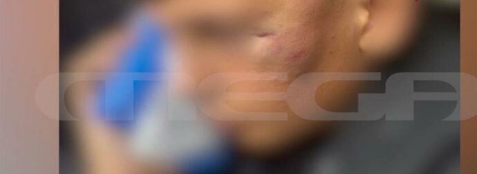 Με βαριές κρανιοεγκεφαλικές κακώσεις 14χρονος που δέχτηκε επίθεση από συμμαθητή του – «Μου λένε “κυρία, πεθαίνει ο μικρός”» (video)